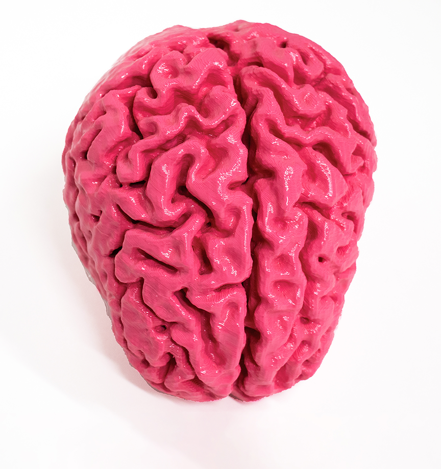 brain_Bakken_resized